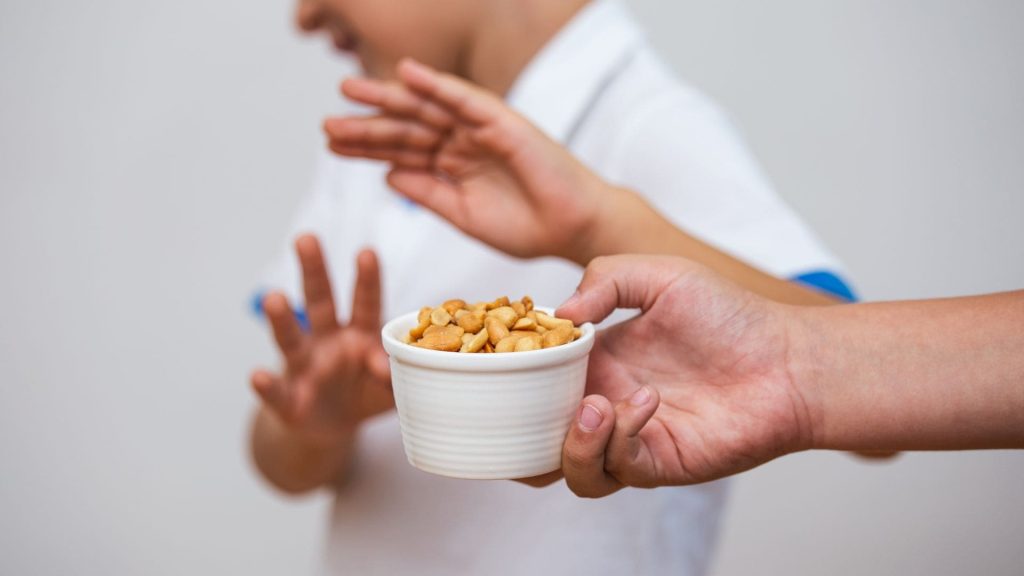 Food allergy
